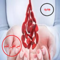 علاج امراض الدم Apk