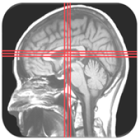 Изображения MRI PLANNING AND PATHOLOGY ANATOMY на ПК с Windows