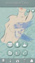 Breast Implant Turkey APK Download for Android