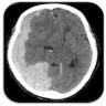 Emergency Of Head CT Application icon